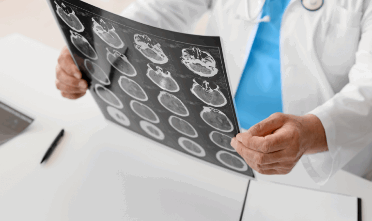 Doctor examining a brain scan with multiple cross-section images, representing a traumatic brain injury case in Connecticut