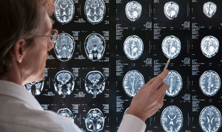 Doctor reviewing multiple brain scan images to assess trauma – legal support for traumatic brain injury victims in Connecticut.