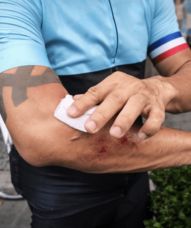 : Cyclist with arm abrasions being treated after a crash – road rash injury lawyer Connecticut