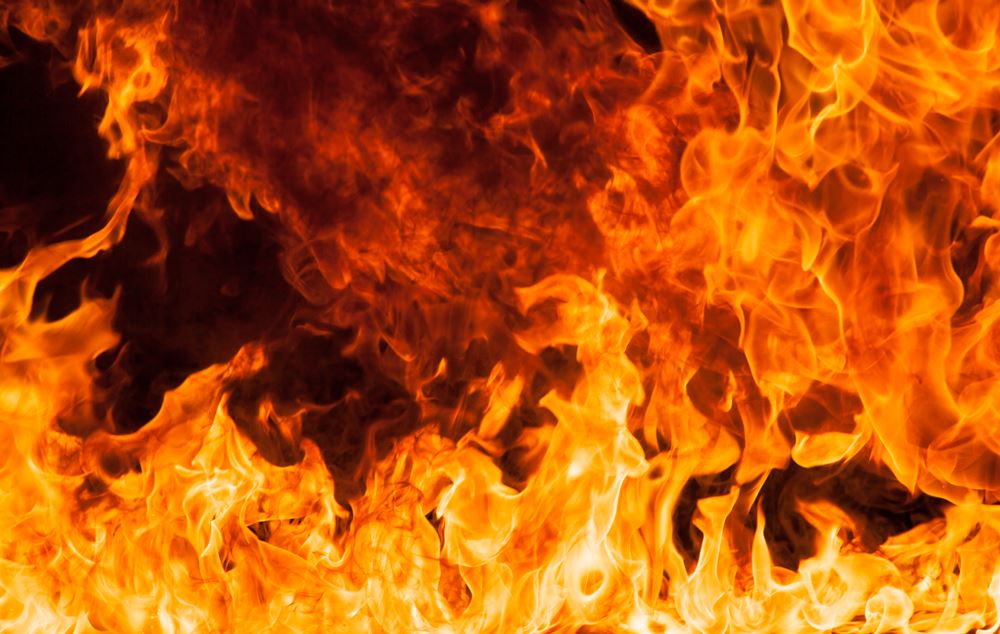 Man Burned in House Fire on Park Rd